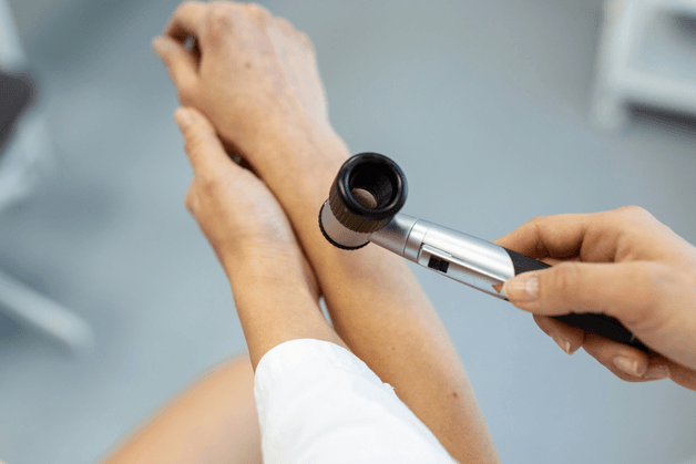 Kožní výrůstky: Kdy jsou neškodné a kdy je čas zajít na dermatologii?