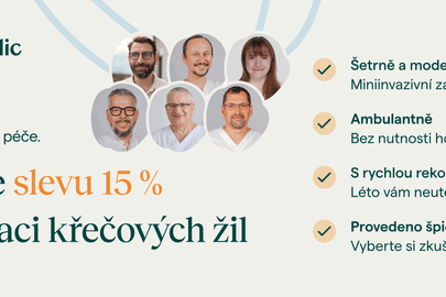 15% sleva na operaci křečových žil