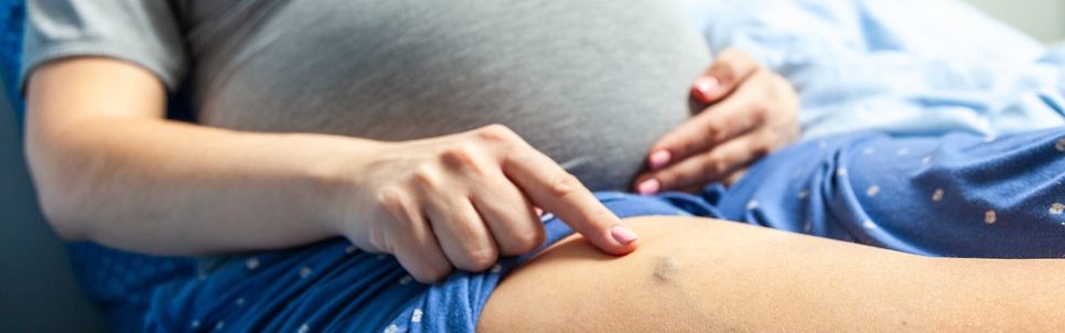 Zhoršení křečových žil v těhotenství