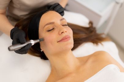 Microneedling: Přirozená stimulace pleti pro mladší vzhled
