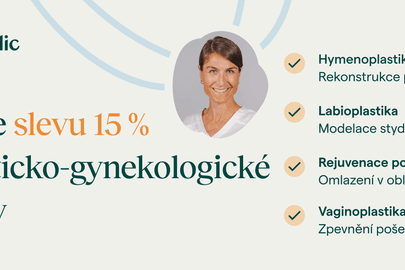 15% sleva na laserové esteticko-gynekologické zákroky