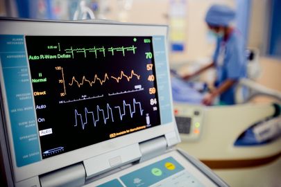 Komplexní kardiologické vyšetření na klinice Vasmedic