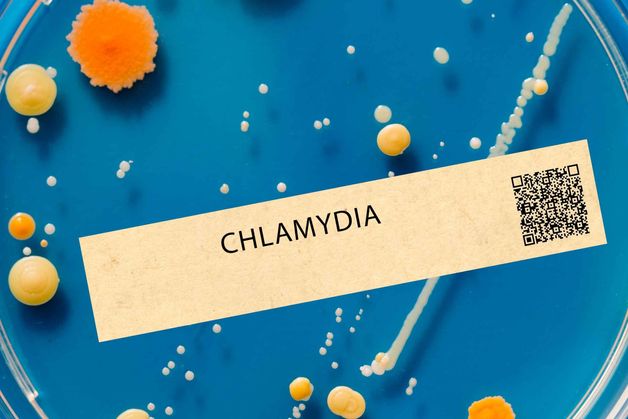 Chlamydie: nejčastější skrytá infekce. Jak ji diagnostikujeme?