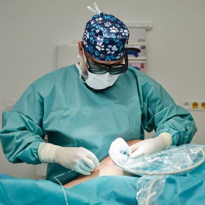 EVLA varicose vein procedure
